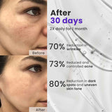 Age-Defy Essentials: Anti Ageing Cream + Anti Ageing Serum