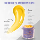 Acne Erase Cream